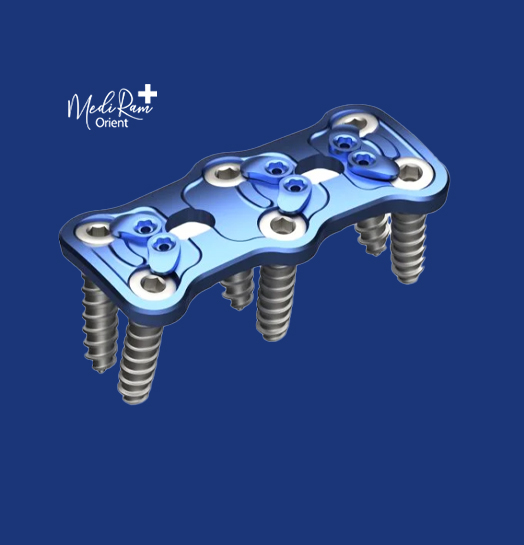 (KS-13 Anterior Cervical Plate – Level II (Sport Medicine