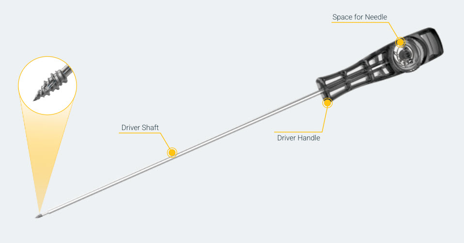 KR-1 Twix Titanium Screw-In Suture Anchor with Needle